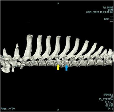 Diagnostic traction and dorsal locking plate stabilization of a fifth and sixth thoracic vertebral fracture/luxation in a golden retriever: Case report